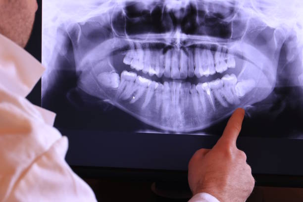 Best Emergency Tooth Extraction  in Madeira, OH