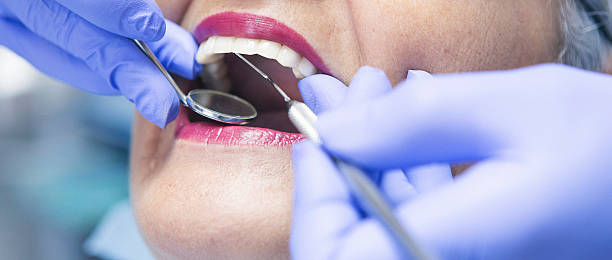 Best Broken Tooth Emergency  in Madeira, OH